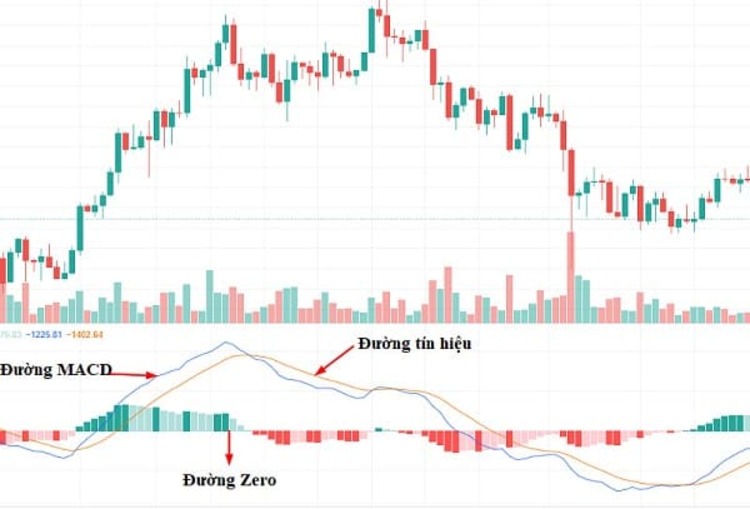 Cấu tạo chỉ báo MACD